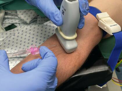 Mit Ultraschall auf den Punkt