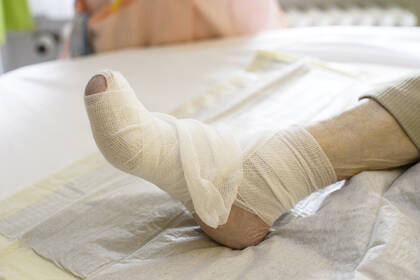 Das Diabetische Fußsyndrom ist vermeidbar – dennoch scheitern präventive Maßnahmen oft an strukturellen Hindernissen.  Das Diabetische Fußsyndrom ist vermeidbar – dennoch scheitern präventive Maßnahmen oft an strukturellen Hindernissen.