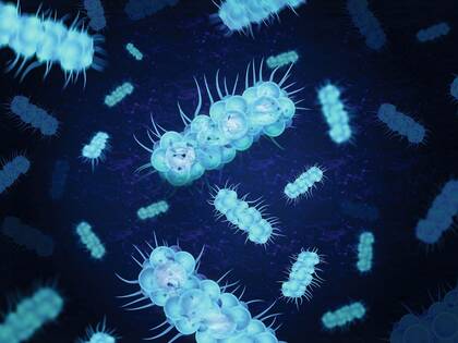 Postoperative Sepsis