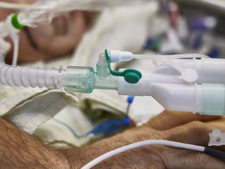 Eine überarbeitete Leitlinie des US-amerikanischen Gesundheits­ministeriums nennt neue Handlungsempfehlungen zur Prävention einer nosokomialen Beatmungspneumonie.
