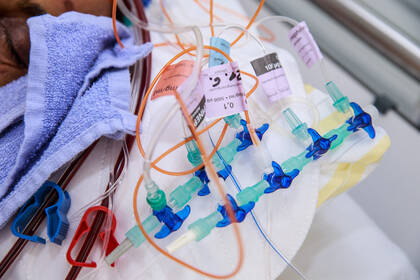 Eine Umfrage der DGHO zeigt: Pflegefachpersonen in der Hämatologie und Onkologie sind gezwungen, viele Tätigkeiten der Patientenbehandlung nicht auszuführen. 