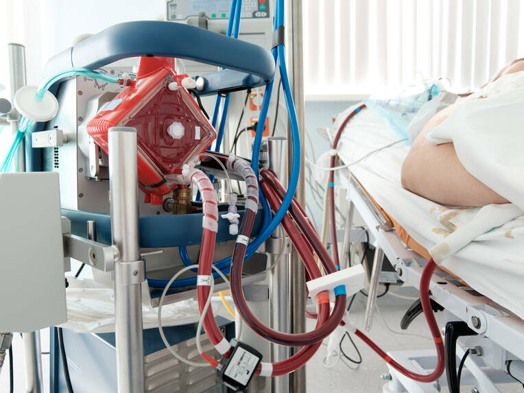 Zusammen Qualität verbessern