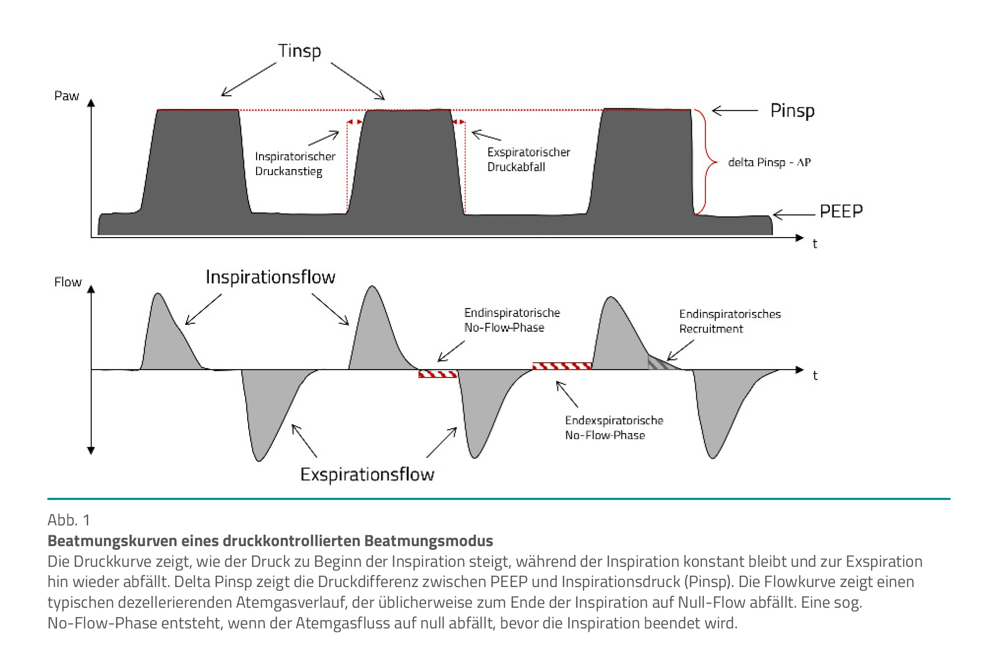 Einstellparameter kennen Beatmungskurven interpretieren