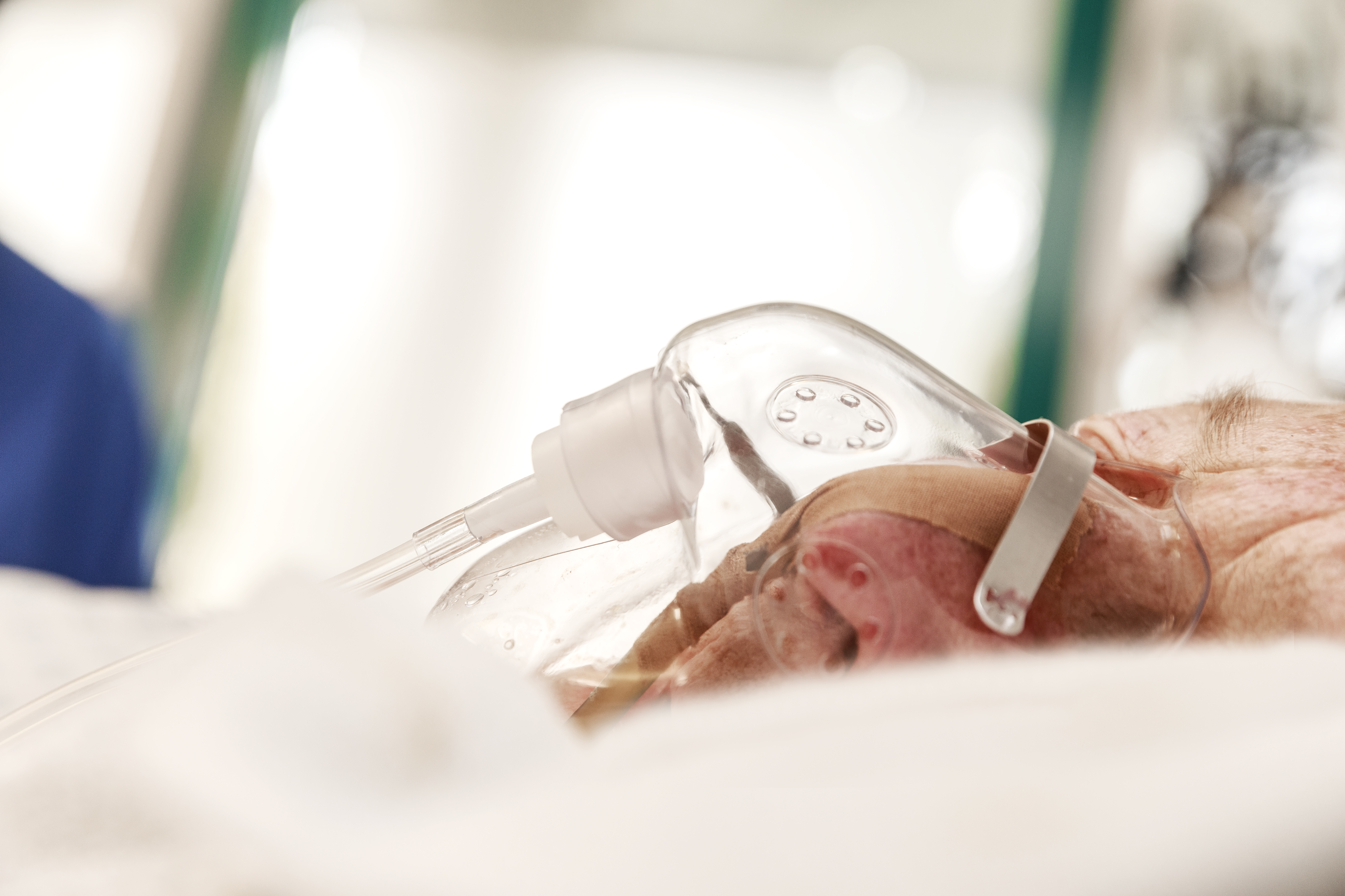 Mundpflegemethoden, die Einhaltung standardisierter Protokolle und regelmäßige Schulungen verbessern die Pflegequalität und senken das Risiko von Pneumonien.